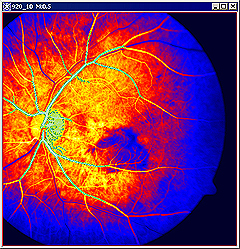 RetinaVessels BlueLUT.jpg