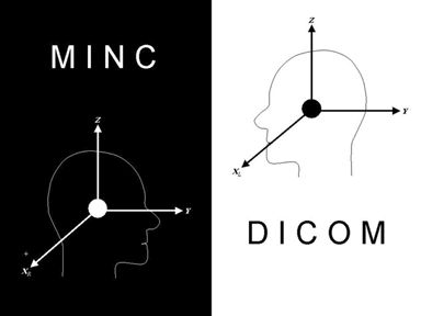 Comparison of MINC and DICOM image orientation