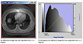 Thumbnail for version as of 20:25, 12 June 2012