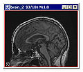 Thumbnail for version as of 20:27, 12 June 2012